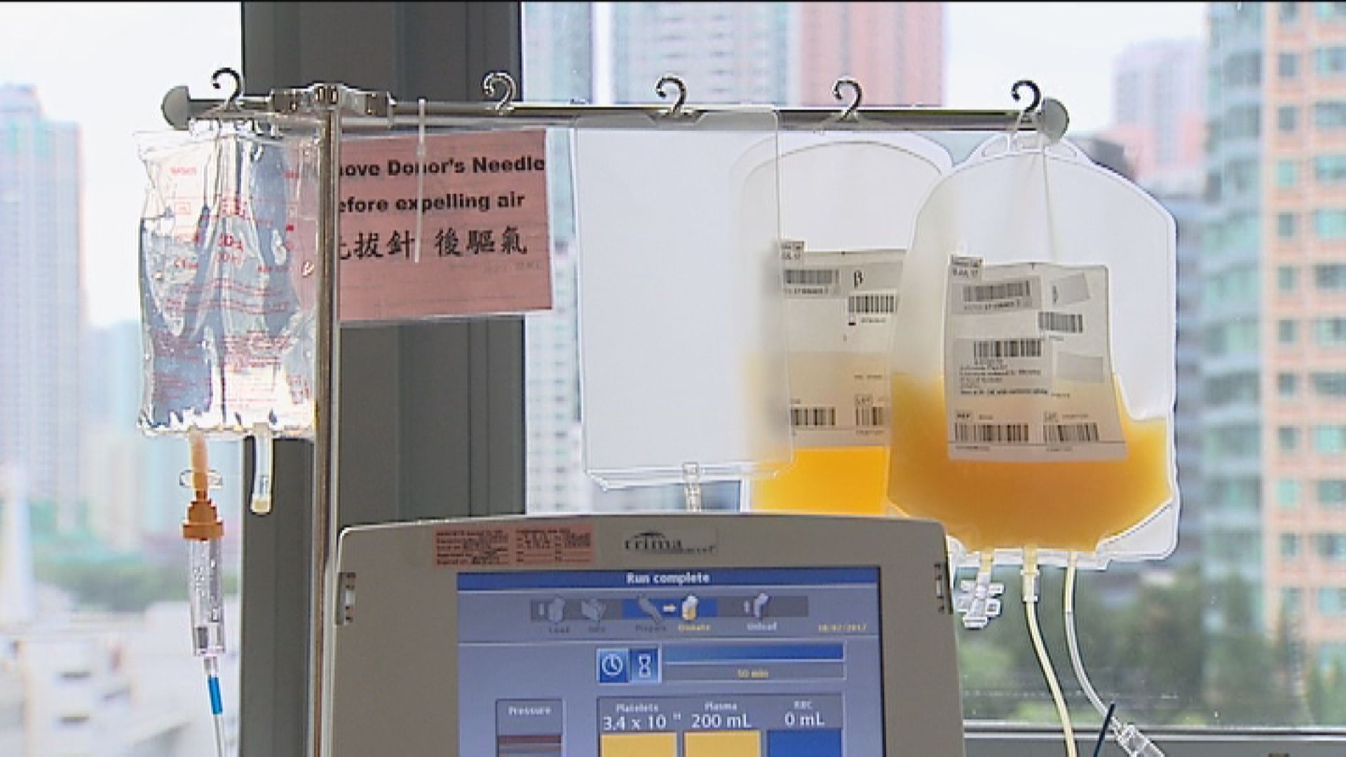 女患者接受血漿治療後病毒量大減九成九