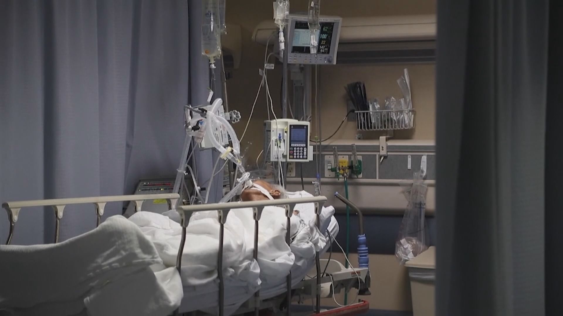 新冠患者脫離呼吸機後遲遲未甦醒　醒後現不同程度認知障礙