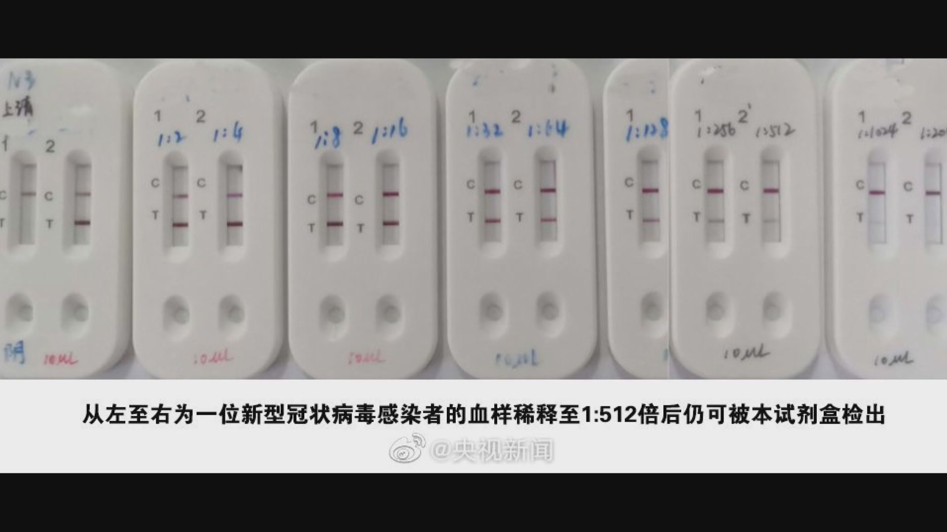 新型冠狀病毒15分鐘測試盒面世