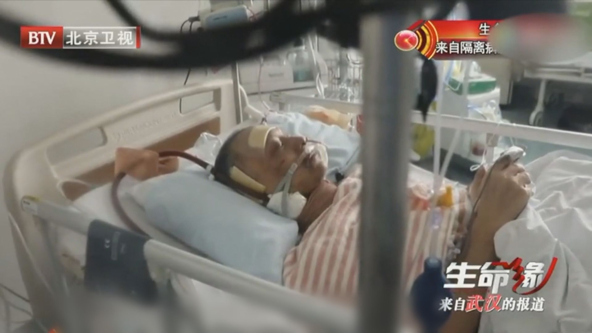 武漢兩確診醫生治癒後身體發黑