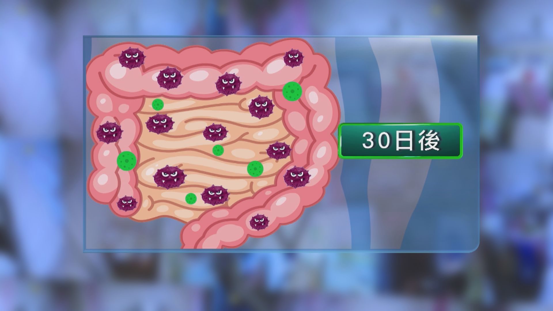 中大：新冠患者體內病毒清除後腸道益菌仍偏低