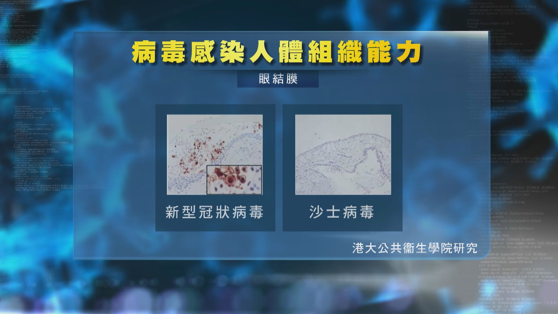 港大研究：新冠病毒遠比沙士容易感染支氣管及眼晴