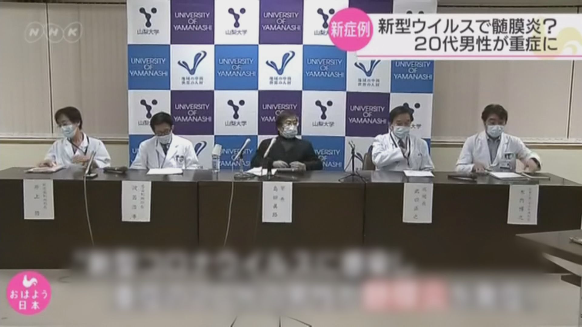 日本首次有患者確診新型肺炎引致腦膜炎