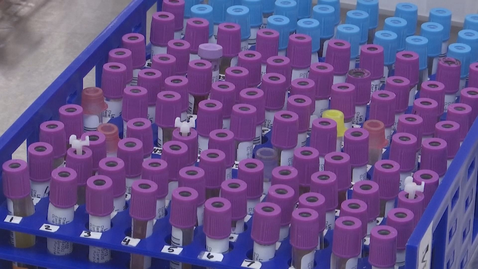 研究指美國新型冠狀病毒抗體測試誤測率高