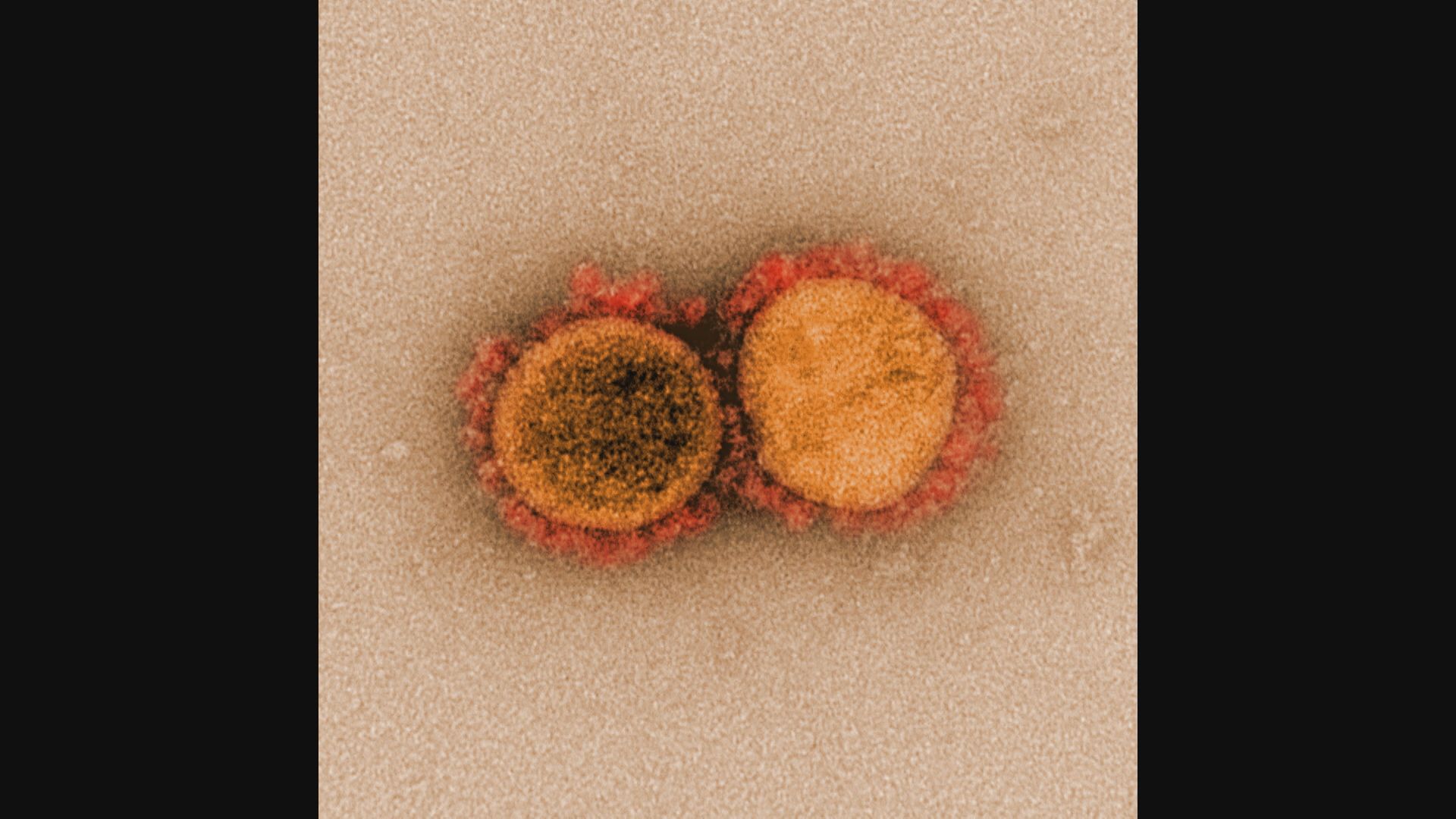英國變種新冠病毒株傳染力較高但非較致命