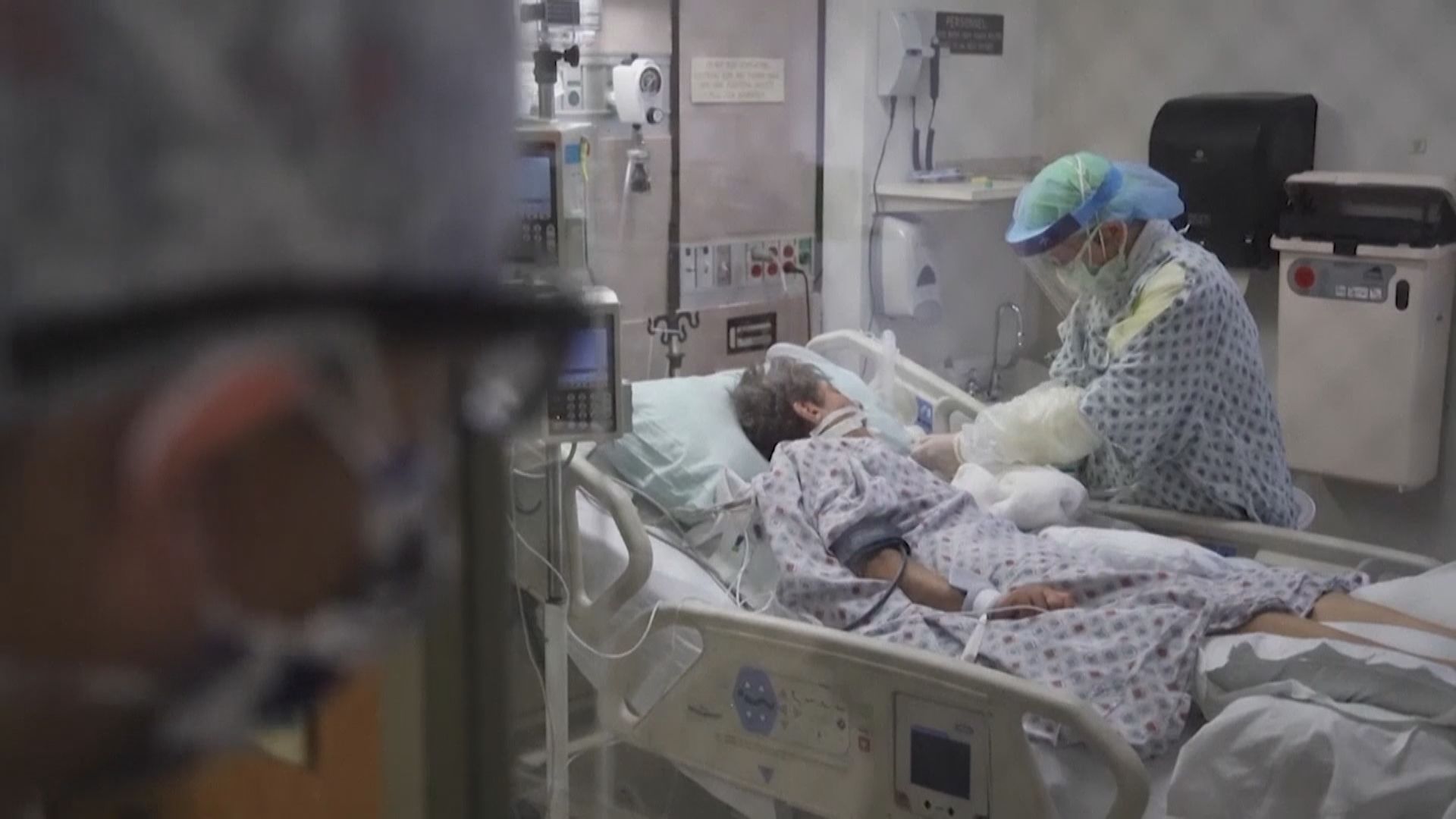 加州驗屍證實美國首宗死亡個案二月初已出現