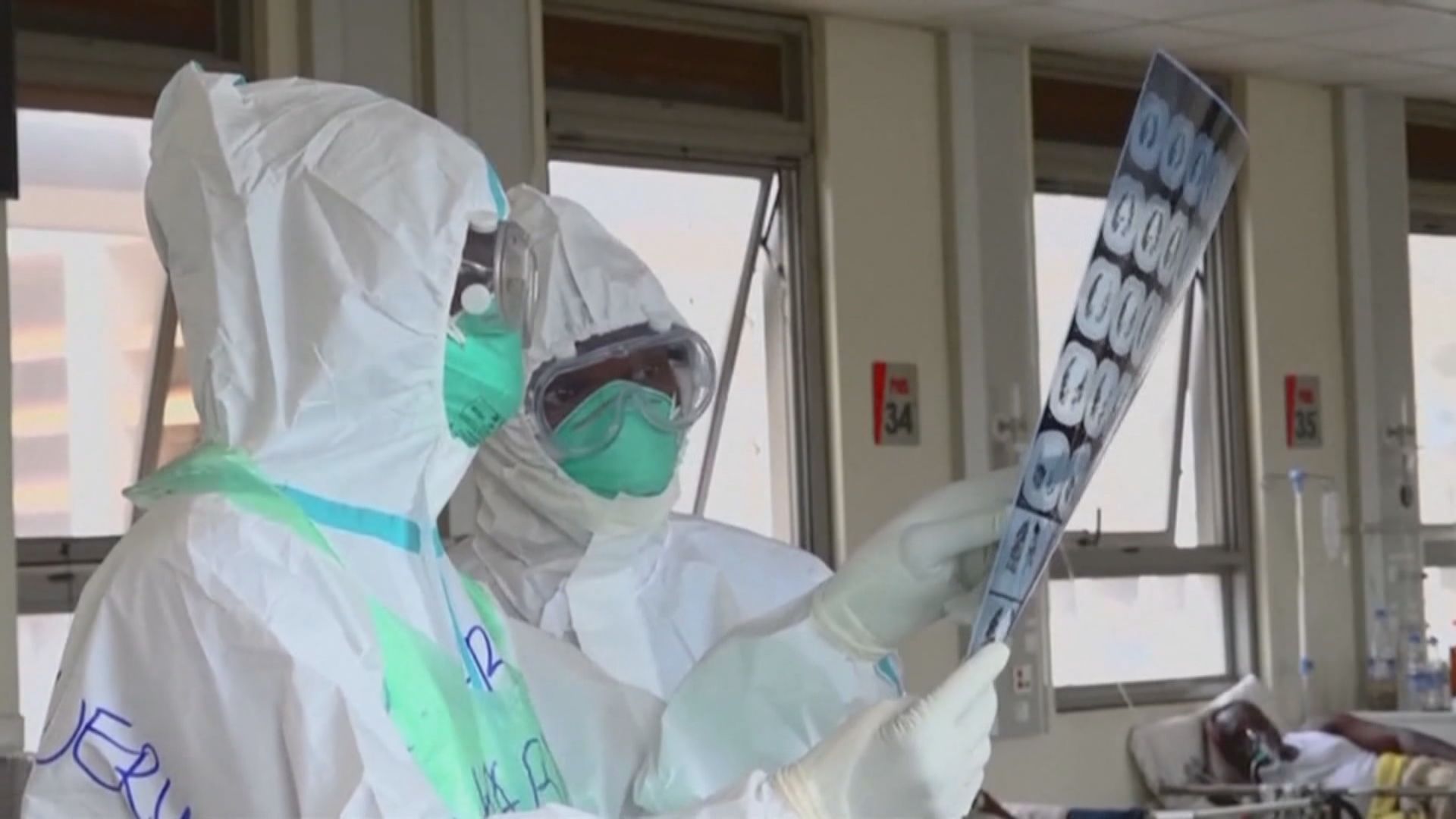 南非發現新變種病毒株　世衛開會進行評估