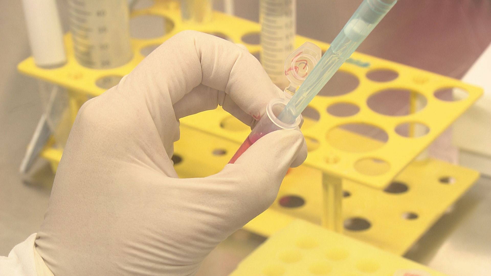 袁國勇研究團隊：Omicron複製能力和致病性低於其他變種病毒