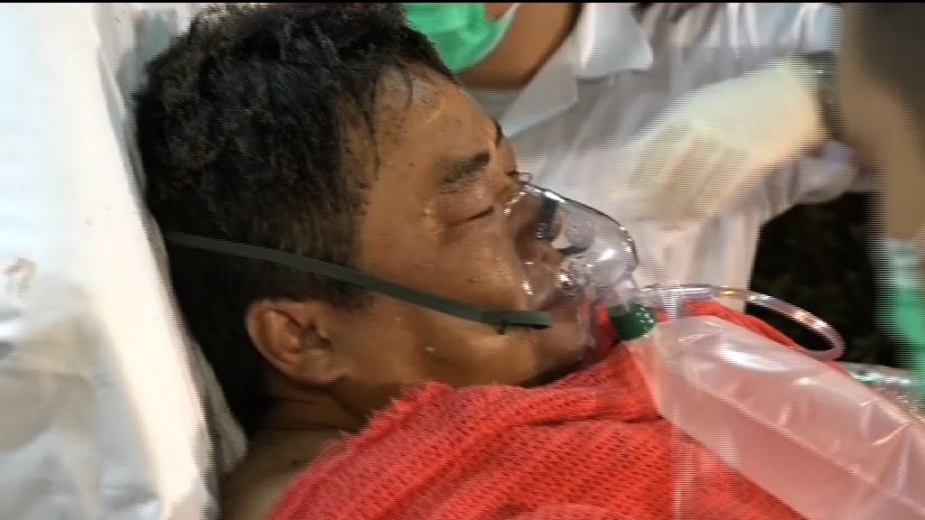 赤鱲角工人燒傷送院